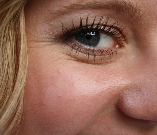 wrinkles